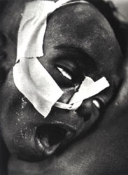James DuJour, two months old, gasps for air in St. Catherines Hospital in Haiti. Every year, 19,200 of the countrys children die before reaching their first birthday. Forty percent of those deaths are from diarrhea caused by poor sanitation and a lack of clean water.
